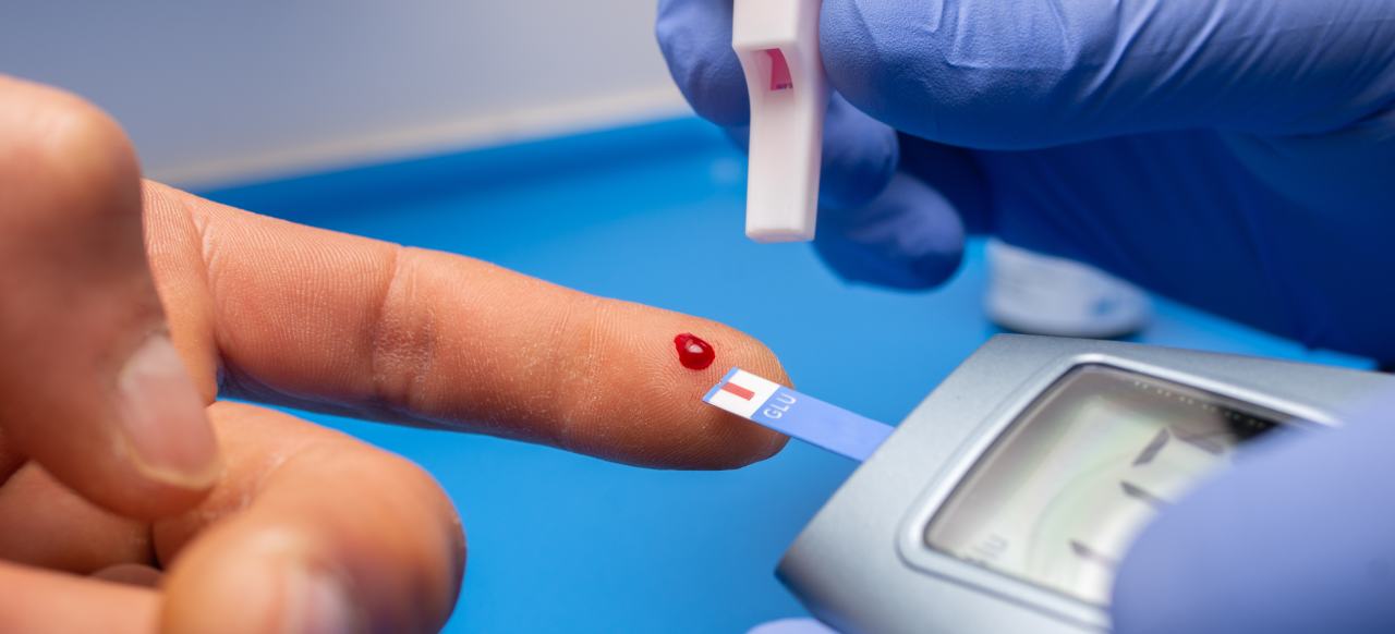 Medición de glucosa en un dedo, con tira reactiva y medidor.